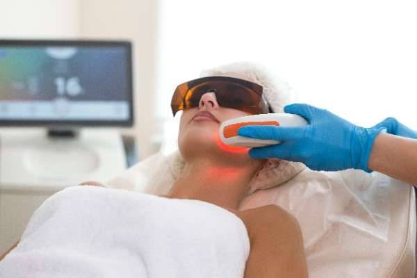 laser hair removal in Battersea